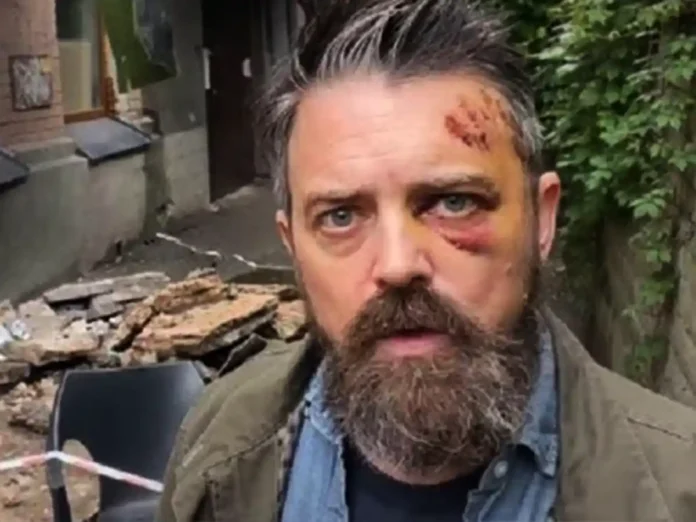 У Києві аварійний балкон не витримав американця