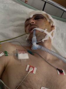 Затриманий представниками ТЦК чоловік в реанімації на Львівщині