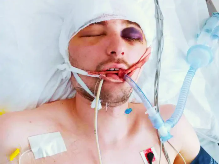 Затриманий представниками ТЦК чоловік в реанімації на Львівщині