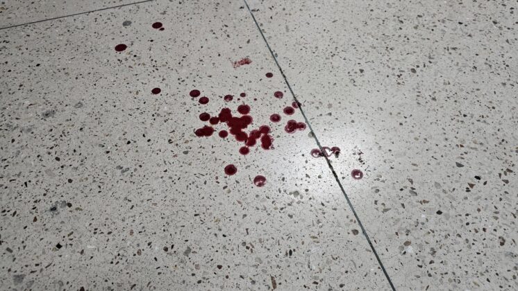 Окупанти обстріляли дитячу лікарню в Херсоні: постраждали діти та медики